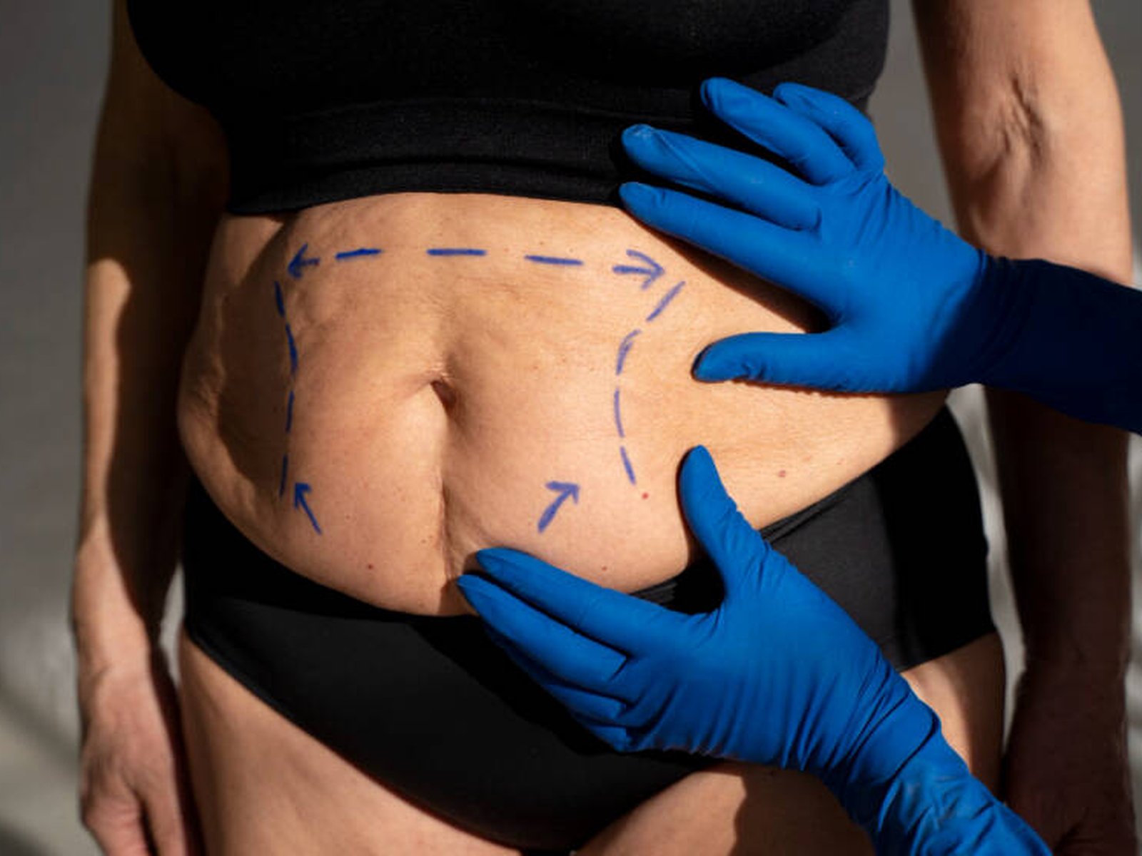 Dr. Cağrı Sade Plastic Surgery Center