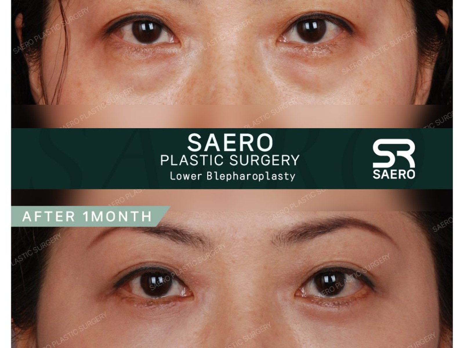 SAERO Plastic Surgery