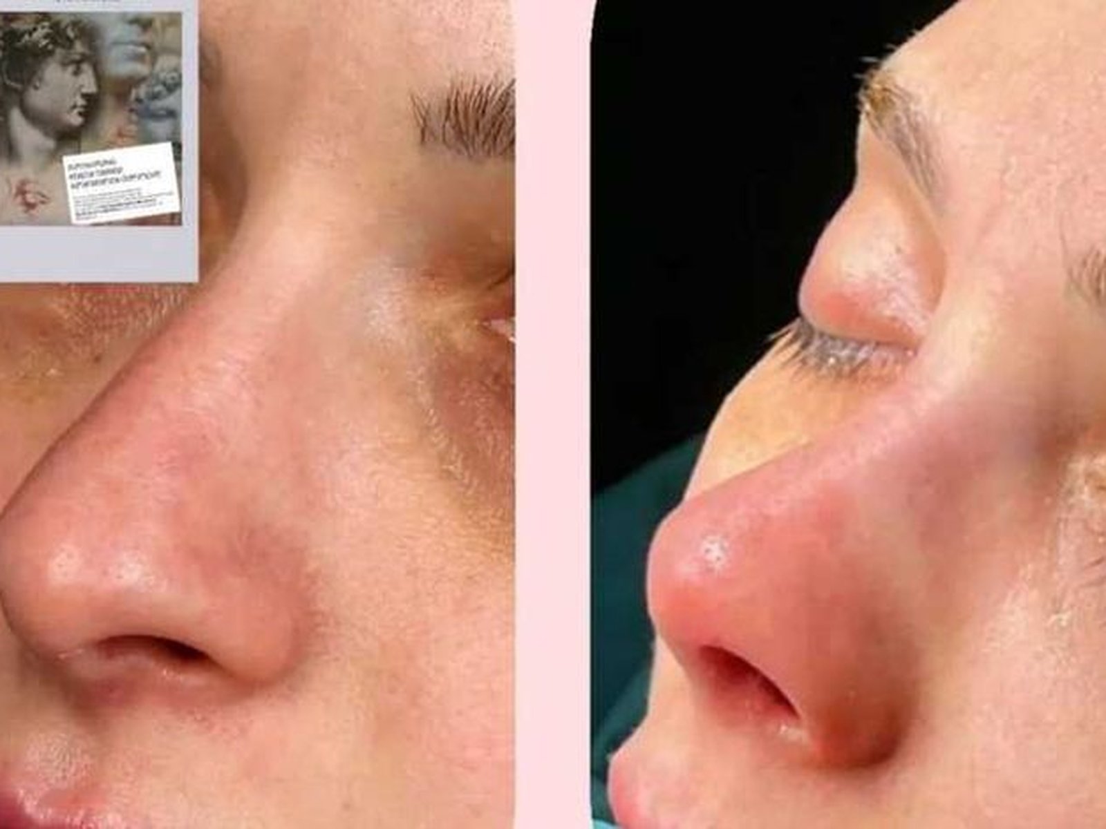 The Nose Clinic