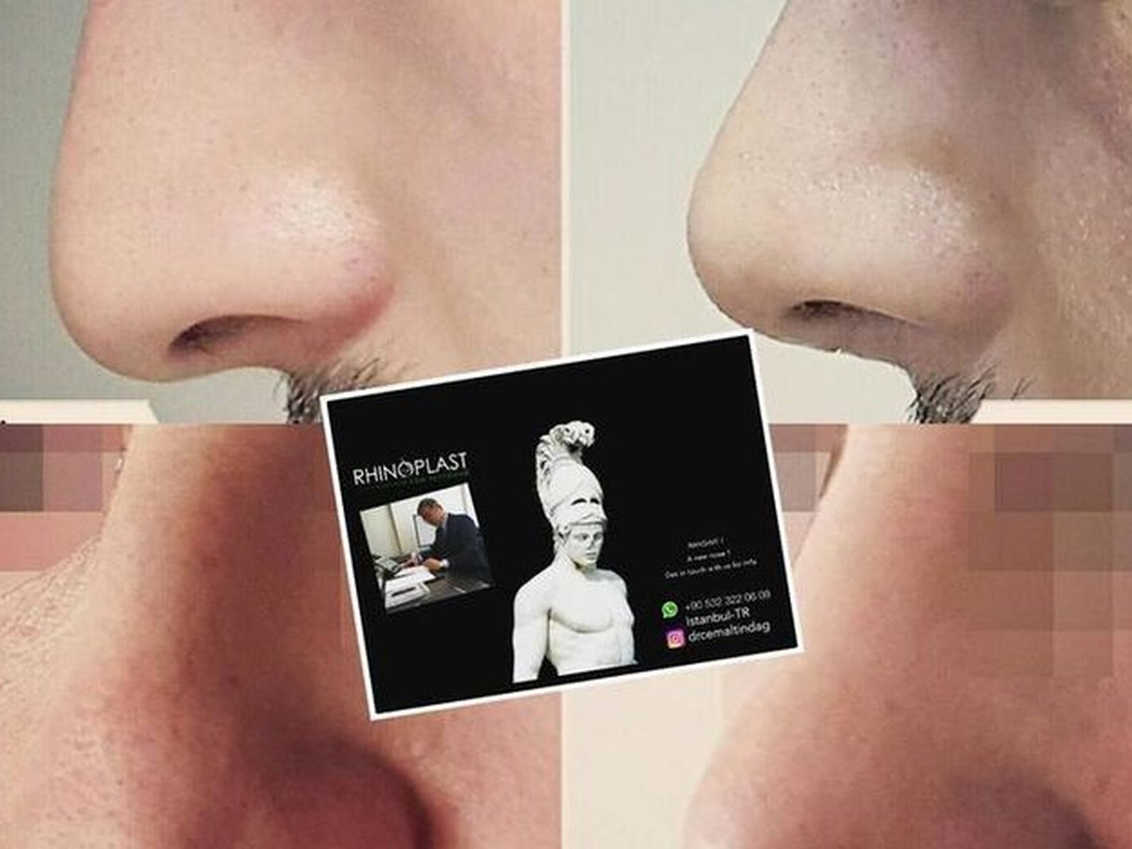 The Nose Clinic