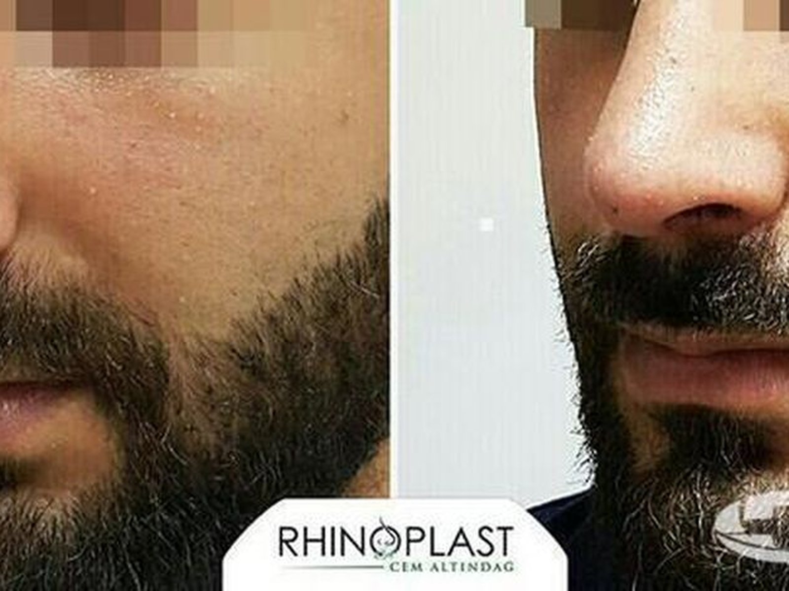 The Nose Clinic
