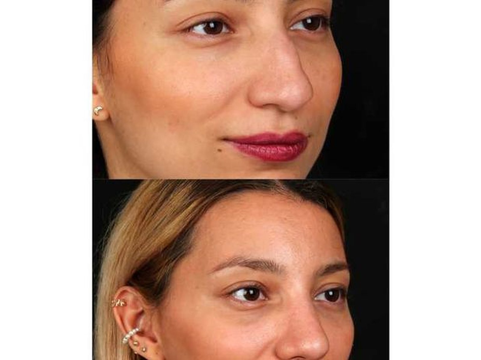 The Nose Clinic