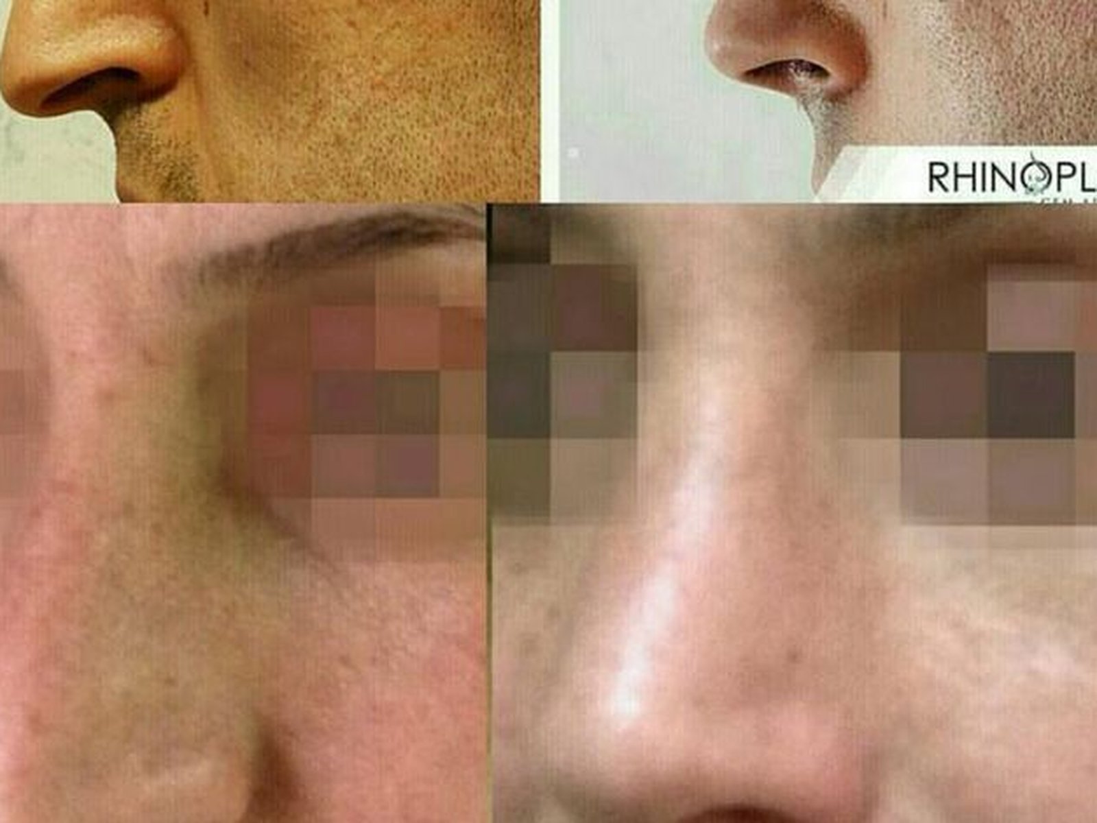 The Nose Clinic