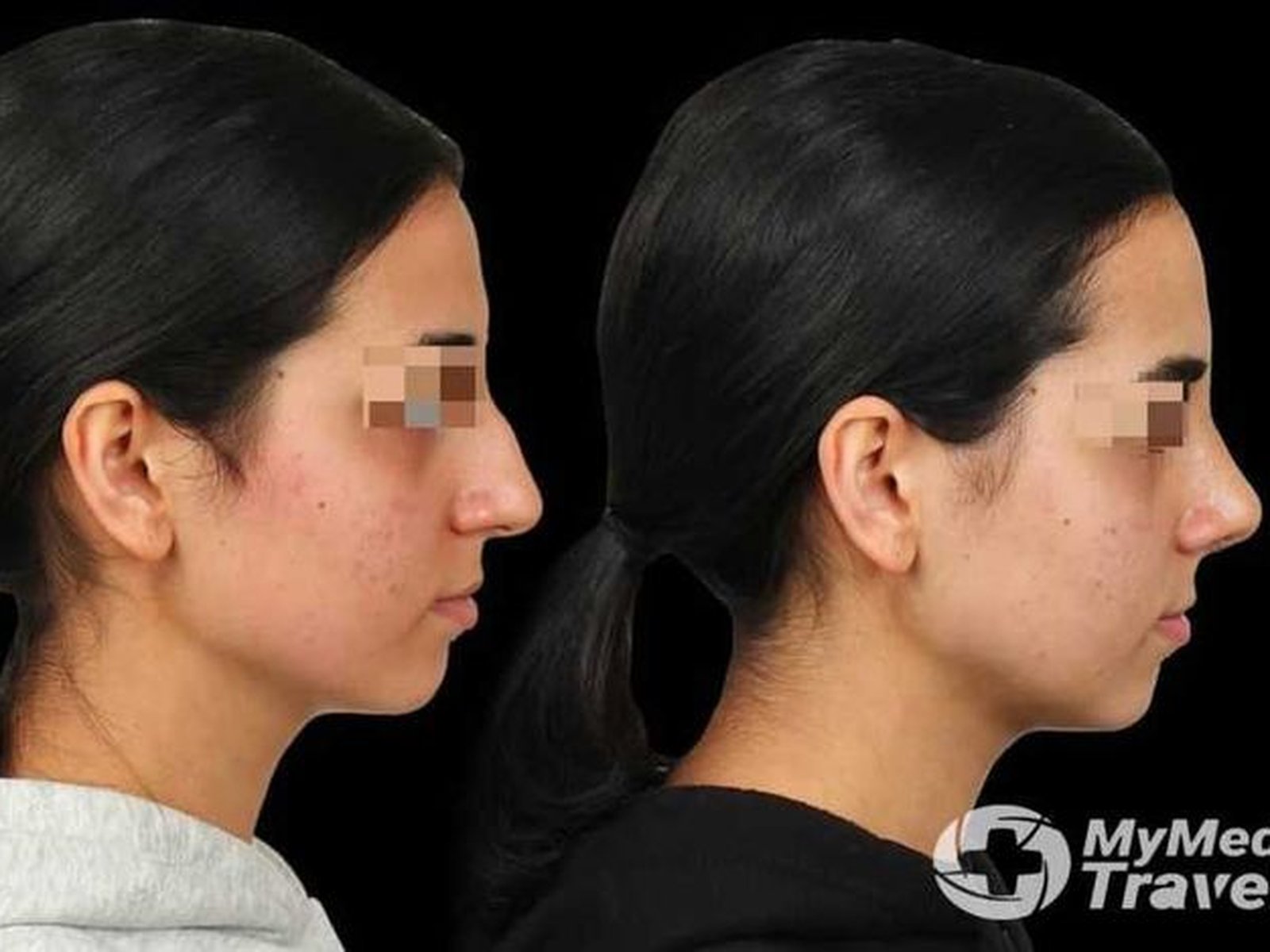The Nose Clinic