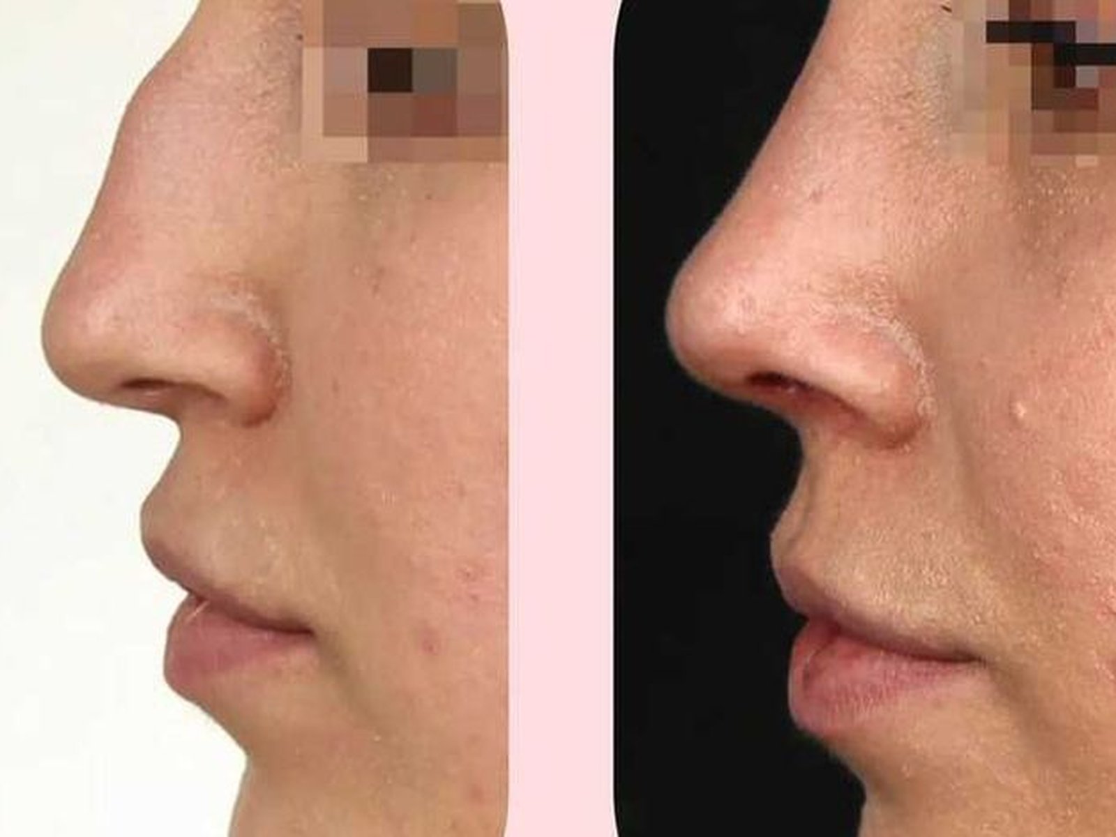 The Nose Clinic