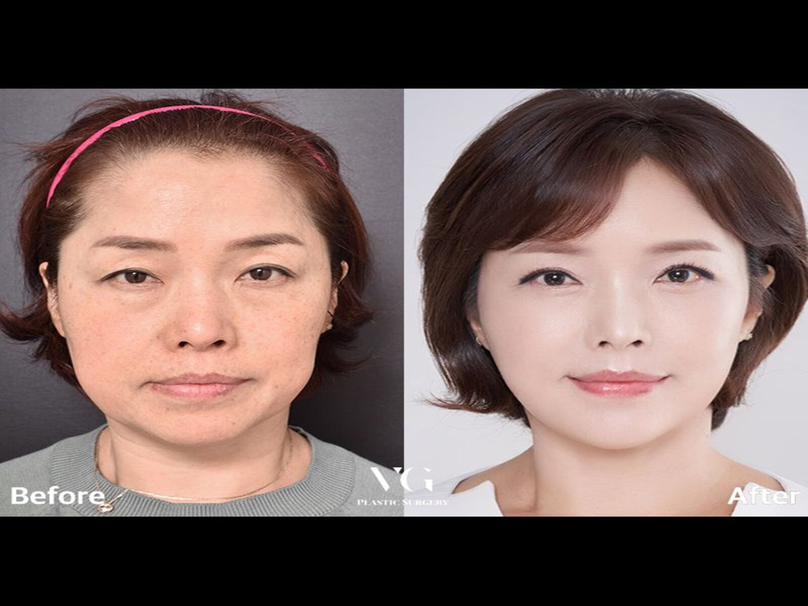 VG Plastic Surgery