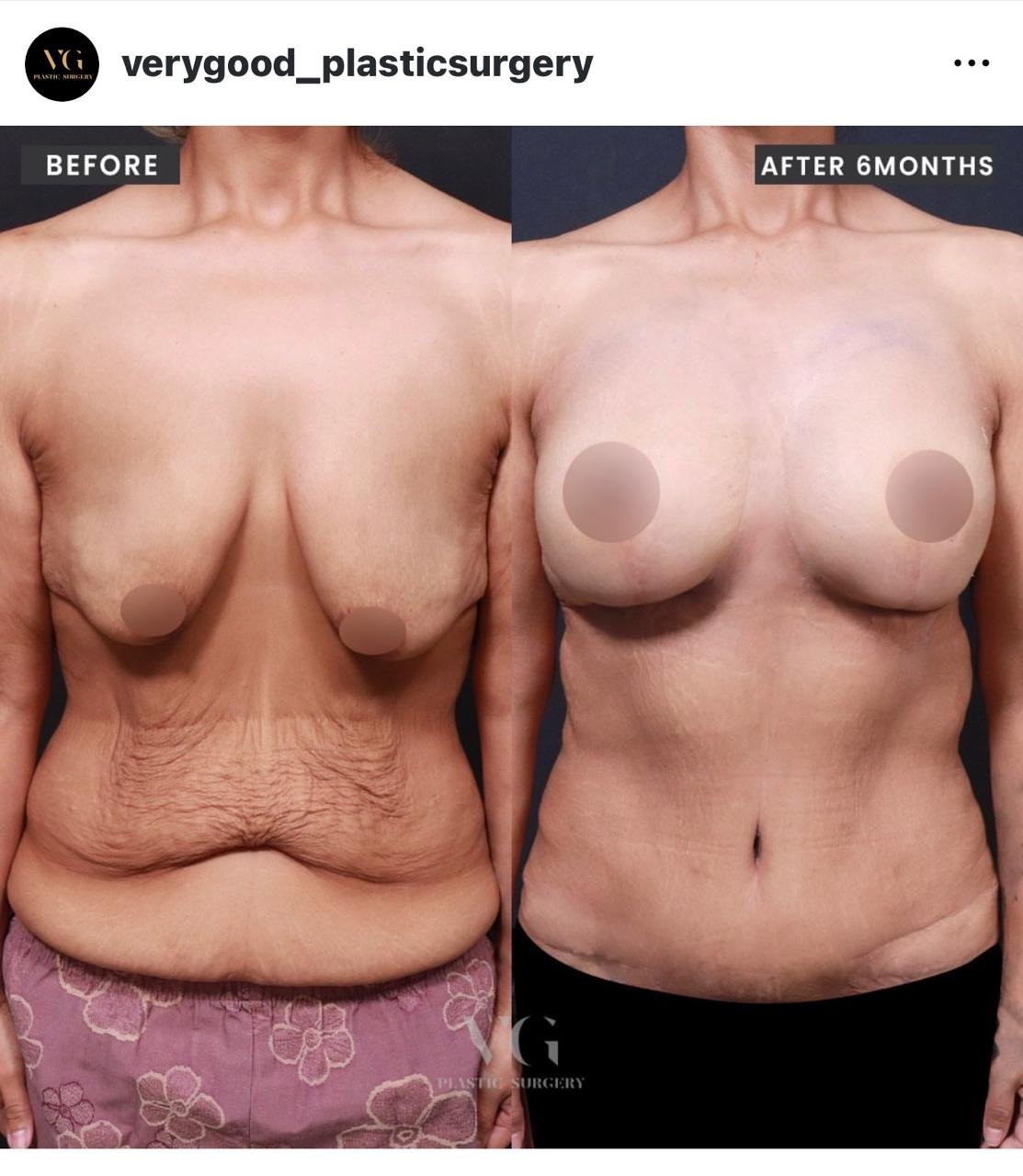 Before and after result by Dr. Kim Yong Woo