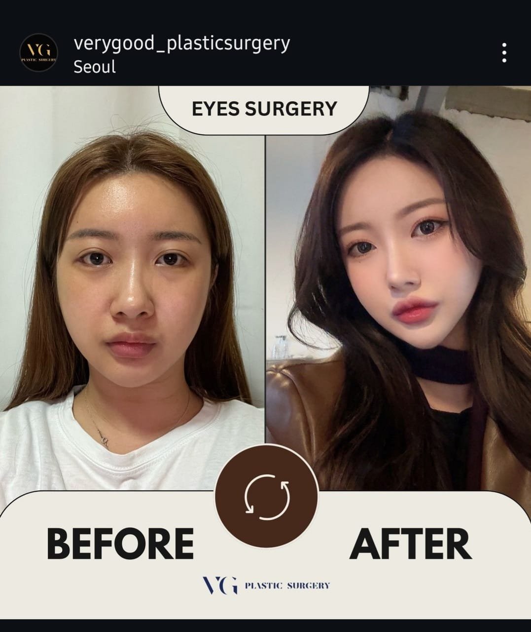 Before and after result by Dr. Kim Yong Woo