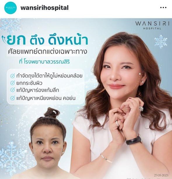 Before and after result by Dr. Jiraroch Meevassana