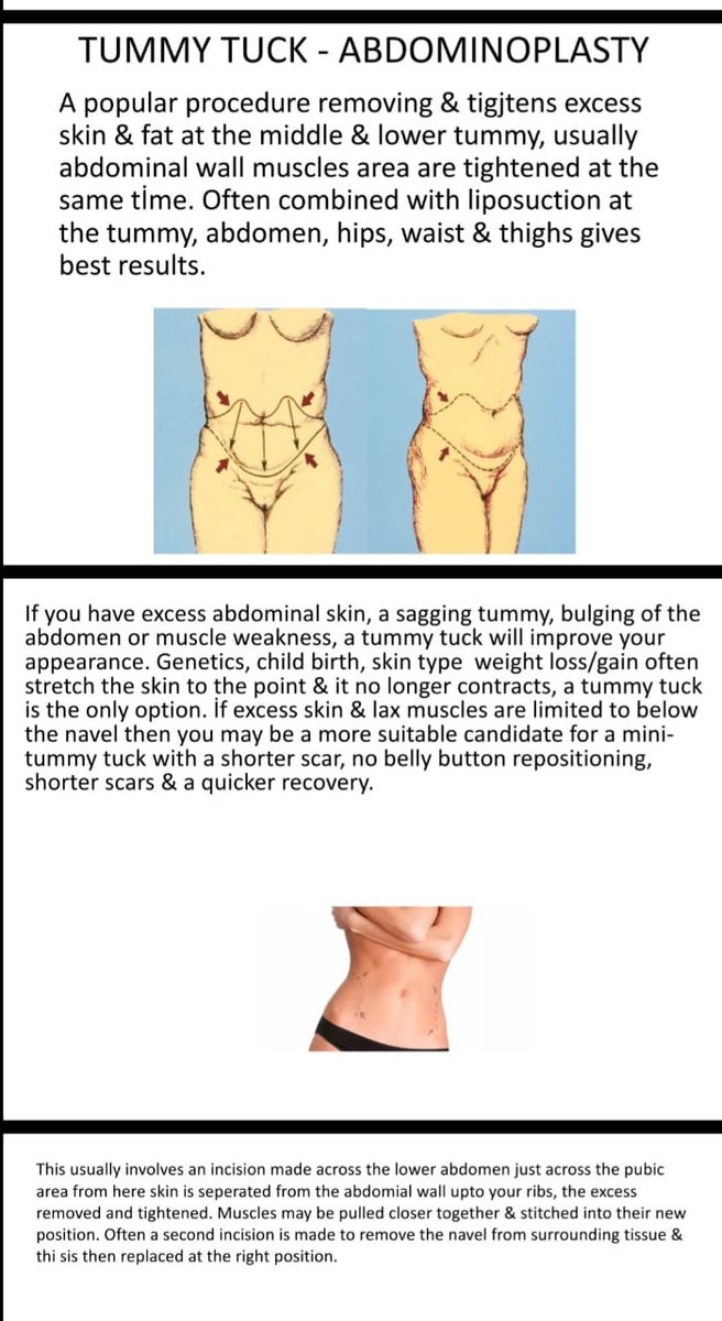 Before and after result by Dr. Çağrı Sade