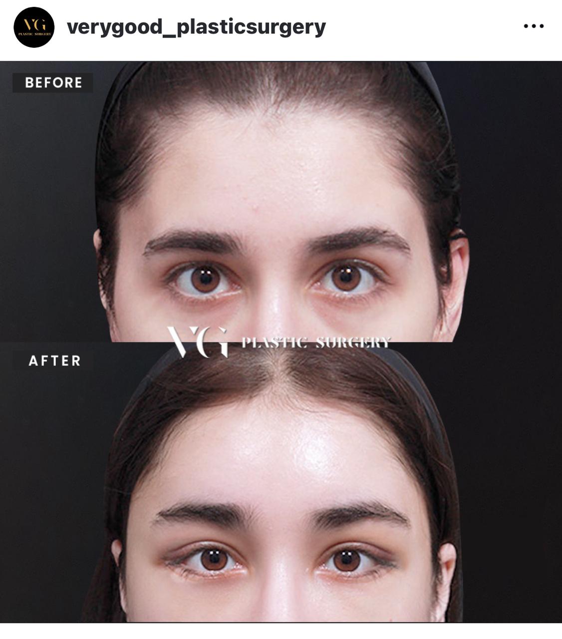 Before and after result by Dr. Kim Yong Woo