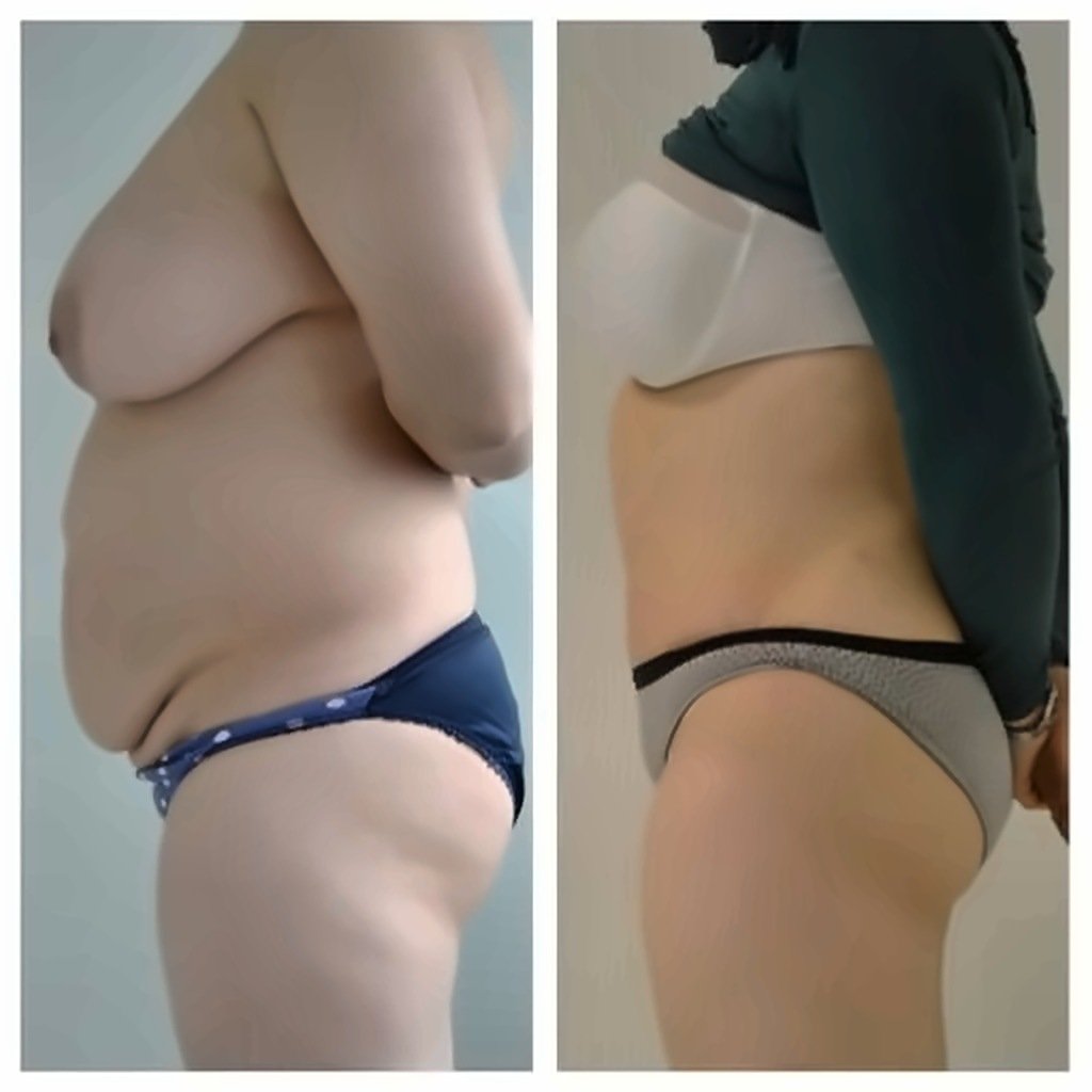 Before and after result by Dr. Ergin Er