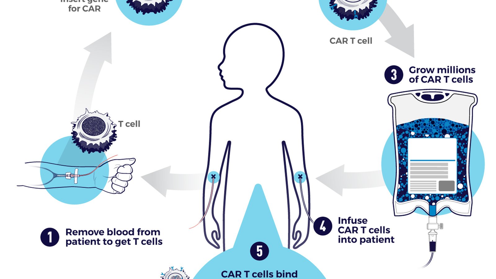 Bone Marrow Transplant / CAR-T