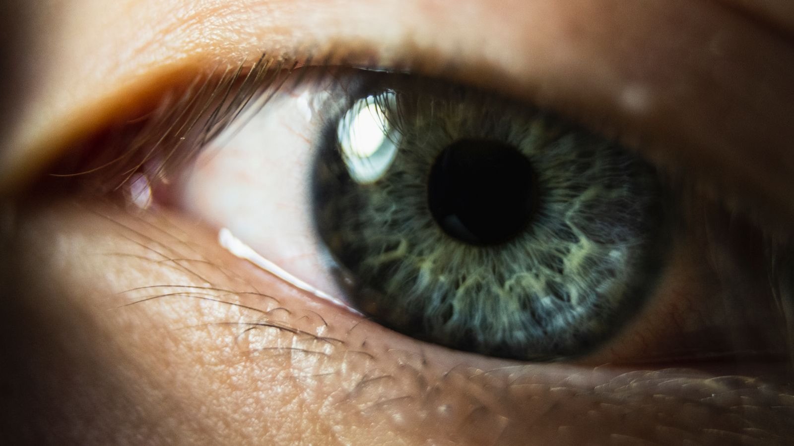 Eyelid Surgery (Blepharoplasty)