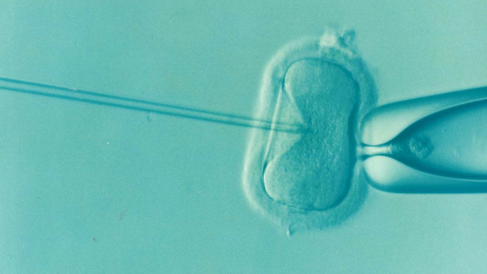 IVF / Fertility Treatment