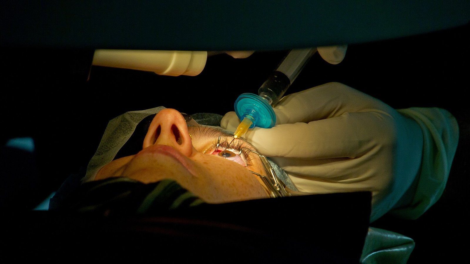 LASIK / ReLEx SMILE Eye Surgery