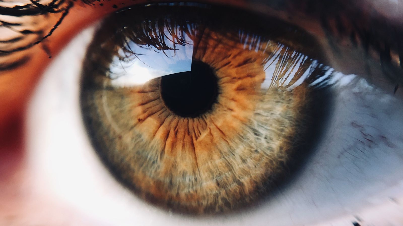 Laser Eye Surgery
