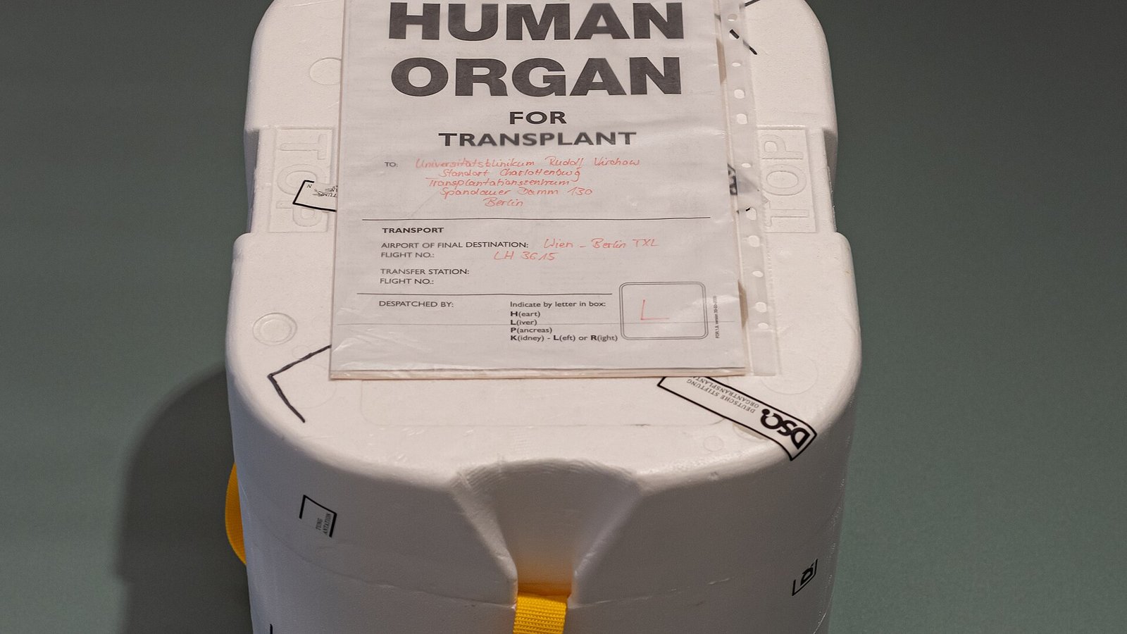 Liver Transplant