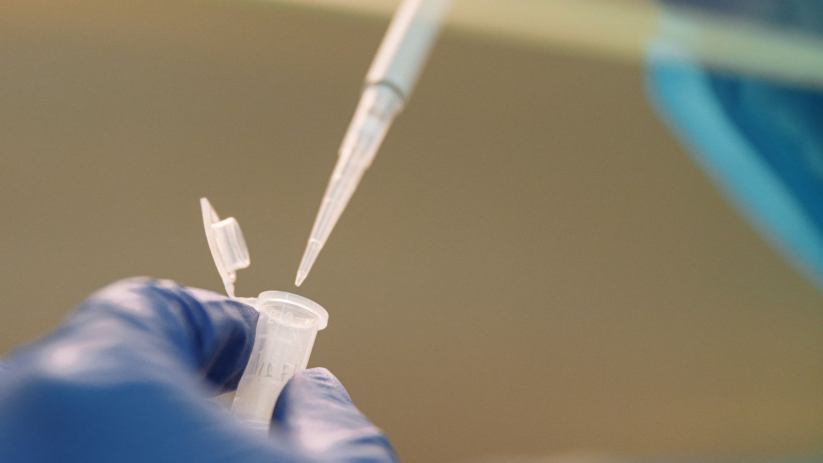 Stem Cell Therapy